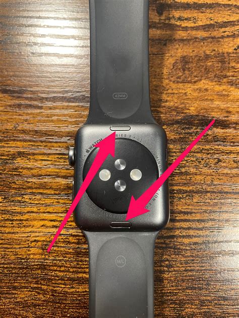 how to remove Apple Watch links